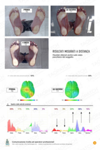 RISULTATI PEDANA E AREEE CEREBRALI STIMOLATE 