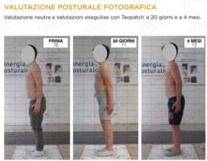 VALUTAZIONE POSTURALE TAO PATCH FISIOTERAPIA PIO X