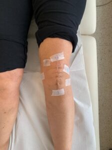 DOLORE CRONICO GINOCCHIO TAO PATCH FISIOTERAPIA PIO X