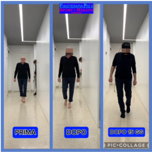 PATOLOGIA NEUROLOGICA E TAO PATCH FISIOTERAPIA PIO X